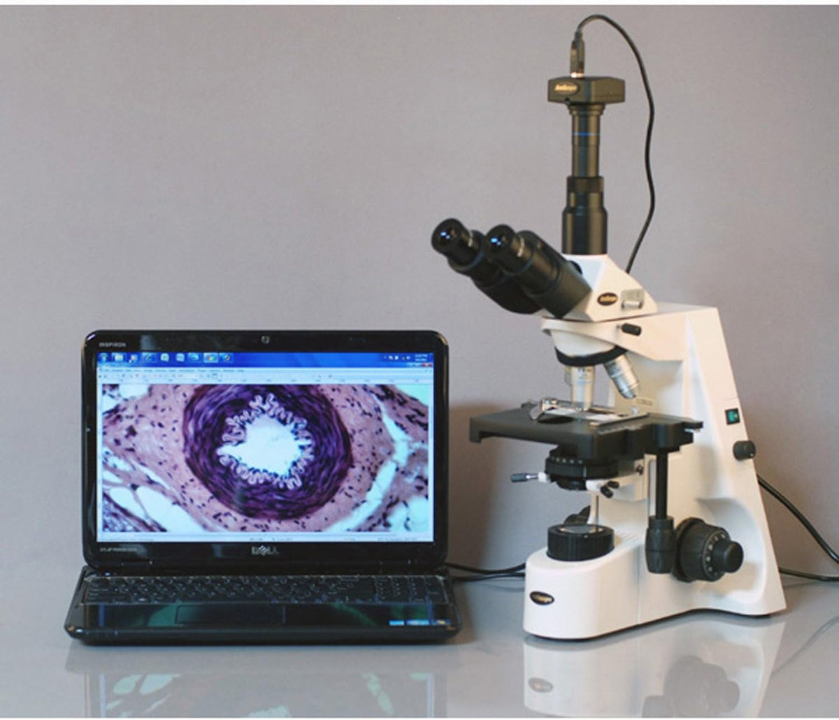 Digital Trinocular Compound Microscope, 40X-2500X Magnification, 5MP Camera O1751